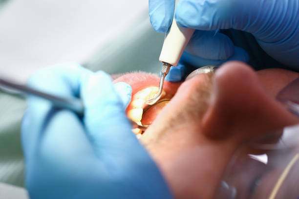 Best Chipped Tooth Repair Near Me  in Weweantic, MA